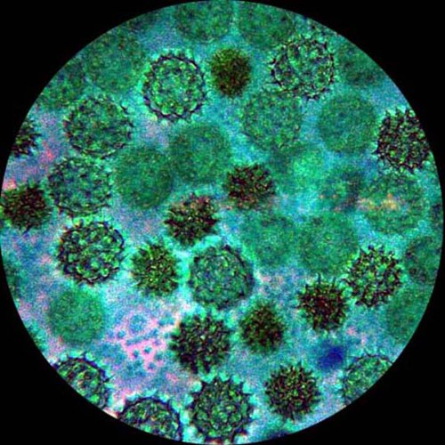 AmScope M158C-2L-PB10-WM Cordless Compound Monocular Microscope, W...