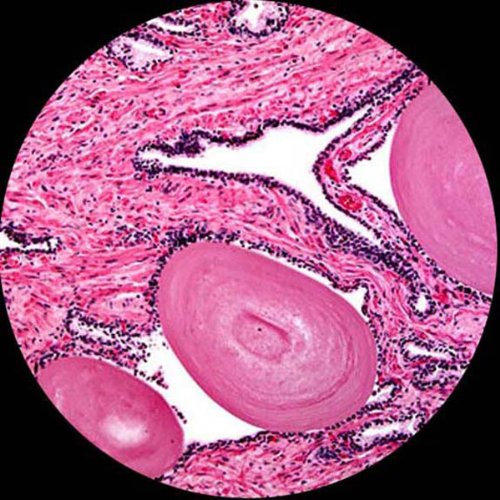 AmScope M220-E Digital Monocular Compound Microscope, WF10x Eyepie...