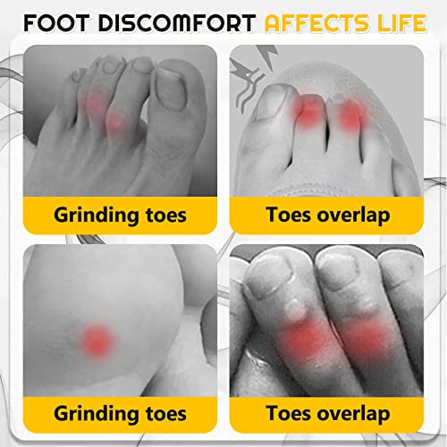 10PCS Silicone Anti-Friction Toe Protector, 2023 New Silicone Brea...