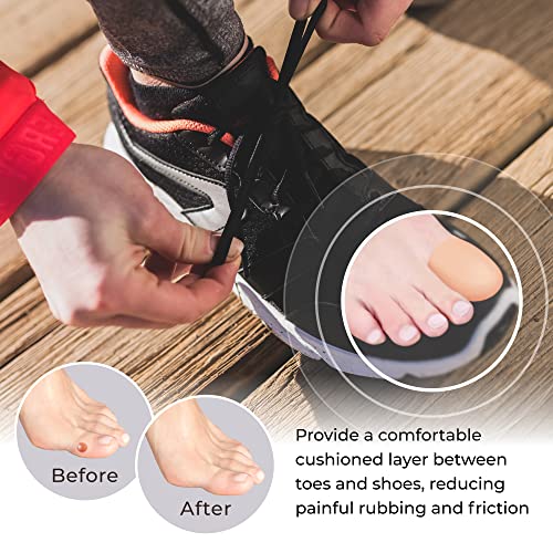 BloomLab Gel Toe Cap and Protector - 6 Big Beige Toe Covers, Cushi...