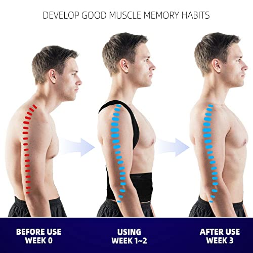 Upgraded Posture Corrector Back Brace for Men and Women, New Versi...