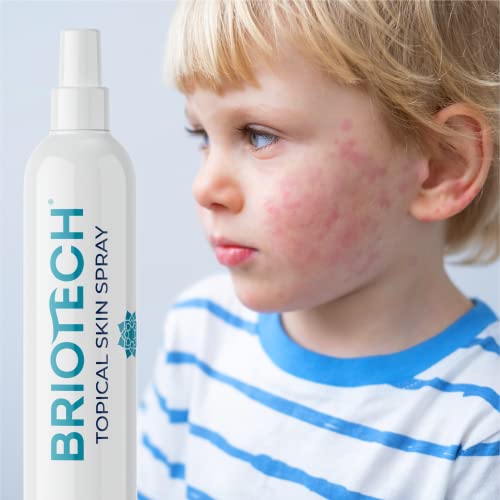 BRIOTECH Topical Skin Spray, Soothing HOCl Pure Hypochlorous, Face...