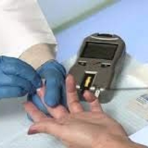 CardioChek Plus Lab-Quality Blood Analyzer and Monitor - Cholester...