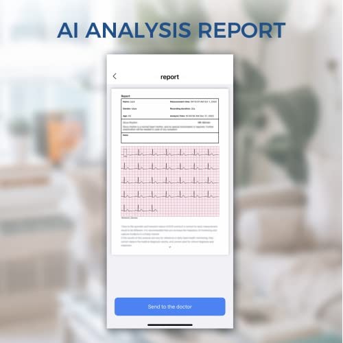 Checkme BP2 Bluetooth Blood Pressure Monitor for Home Use | Wirele...