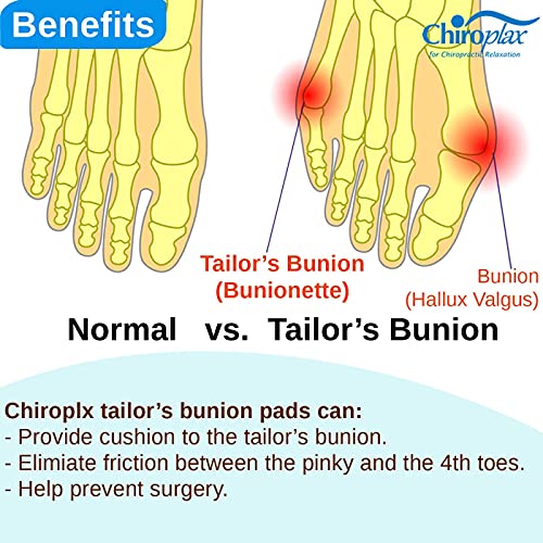 Chiroplax Tailors Bunion Corrector Pads Bunionette Pain Relief Pi...