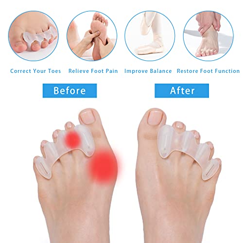 Toe Separator Toe Spacer for Men and Women, Toe Straightener for H...