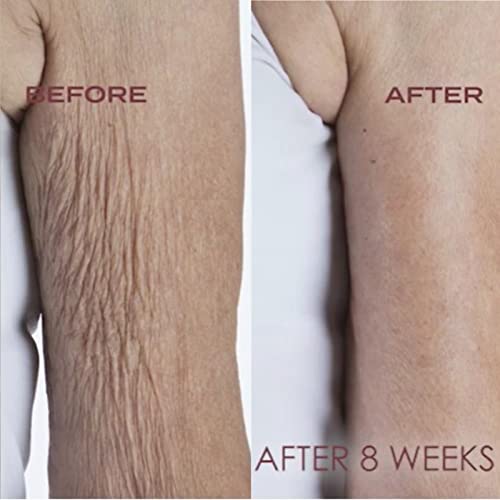 Crépe Erase Advanced Body Repair Treatment | Anti Aging Wrinkle Cr...