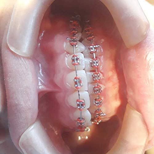 Super Elastic Nickel Titanium Tapered Rectangular Arches - 20 Bags...