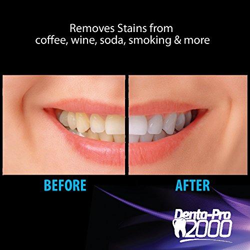 Teeth Whitening Kit - Professional At Home Teeth Whitening - Denta...