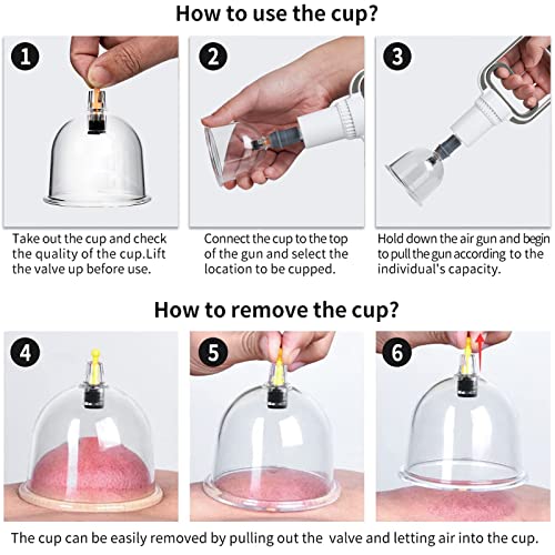 Eambond Cupping Set, Cupping Therapy Sets Massage Back, Pain Relie...