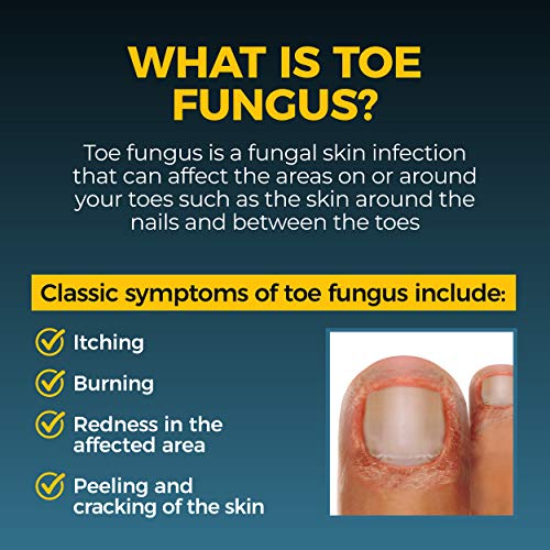 Fungi-Nail Anti-Fungal Liquid Solution, Kills Fungus That Can Lead...