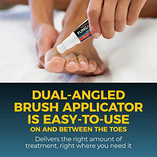 Fungi Nail Anti-Fungal Ointment, Kills Fungus That Can Lead to Nai...