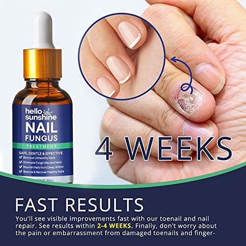 Nail Fungus Treatment for Toenail Extra Strength, Antifungal Solut...