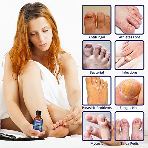 Nail Fungus Treatment for Toenail Extra Strength, Antifungal Solut...