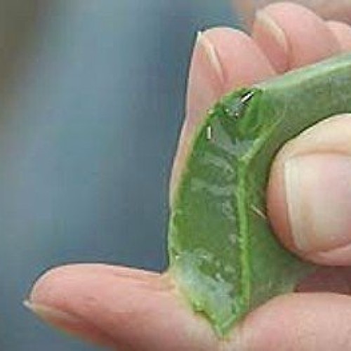 Aloe Vera - Medicine Plant - Burn Plant-Miracle Plant-Natural Heal...