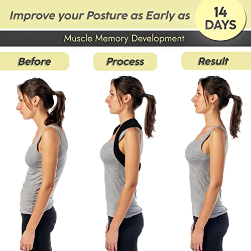 FSA HSA Eligible iBYWM Neck and Shoulder Relaxer with Posture Corr...