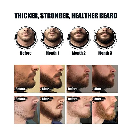 ISNER MILE Beard Growth Kit - Beard Kit with Beard Roller, Beard G...