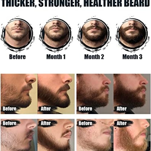 ISNER MILE Beard Growth Kit - Beard Kit with Beard Roller, Beard G...