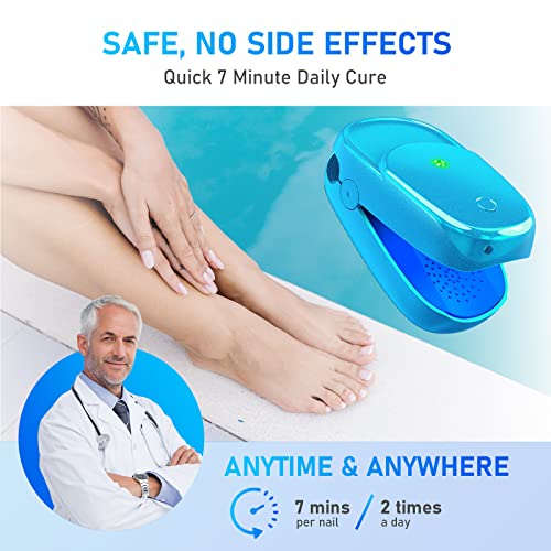 Nail Fungus Laser Treatment, Onychom Laser Cleaning Device for Fin...