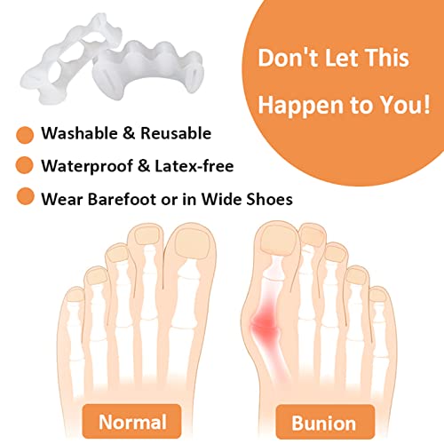 KIYOKI Toe Separators, Bunion Corrector for Women/Men, Toe Spacers...