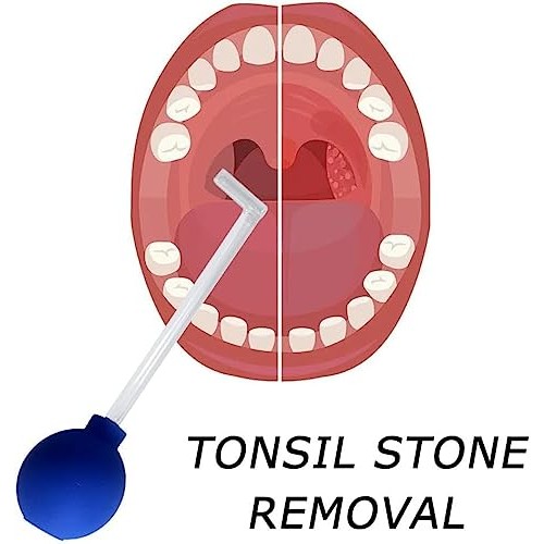 KRONDO Tonsil Stone Remove Tool Manual Style Cleaner Removal Mouth...