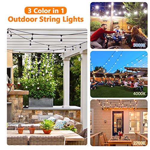 2-Pack 3 Color Dimmable LED Outdoor String Lights for Patio with R...