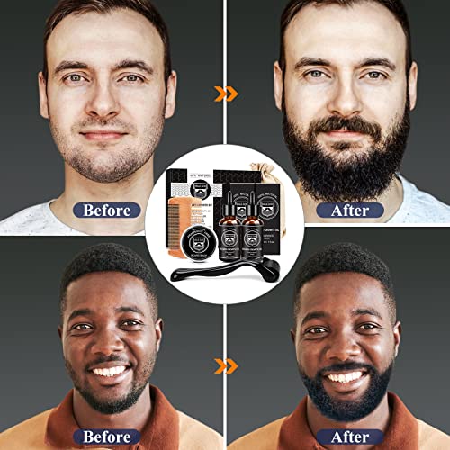 MALE GOD Beard Growth Kit - Beard Kit with Beard Growth Oil2 Pack...
