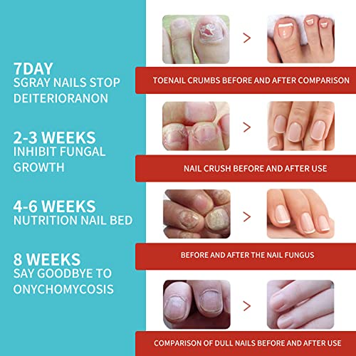 Toe Nail Patches for Fungus,Nighttime Renewal Patches,Fungal Nail ...