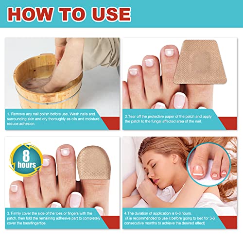 Toe Nail Patches for Fungus,Nighttime Renewal Patches,Fungal Nail ...