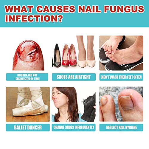 Toe Nail Patches for Fungus,Nighttime Renewal Patches,Fungal Nail ...
