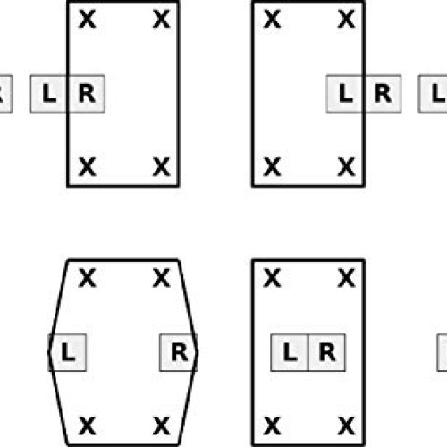 Deluxe Chinese Jump Rope Complete Gift Set Bundle with Bonus Matty...