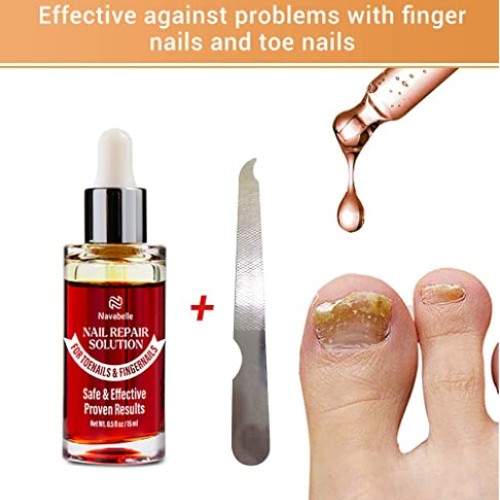 Toenail Fungus Treatment, Toe Nail Fungus Treatment for Toenail Ex...
