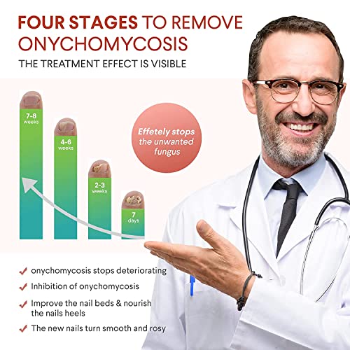 Toenail Fungus Treatment, Toe Nail Fungus Treatment for Toenail Ex...