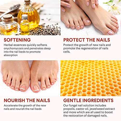Toenail Fungus Treatment, Toe Nail Fungus Treatment for Toenail Ex...