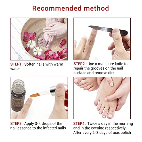 Toenail Fungus Treatment, Toe Nail Fungus Treatment for Toenail Ex...