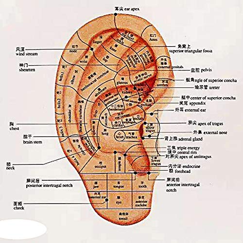 Newkelly Seed 300pcs Therapy Ear Patch Auricular Auriculotherapy A...