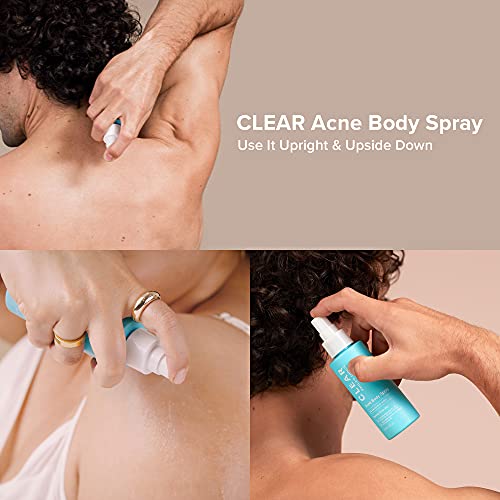 Paulas Choice CLEAR Back & Body Acne Spray, 2% BHA Salicylic Aci...