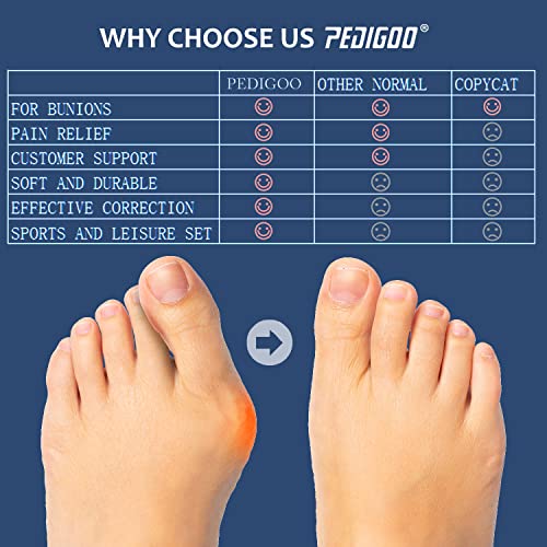 Toe Separator for Overlapping Toes, Bunion Corrector for Women and...