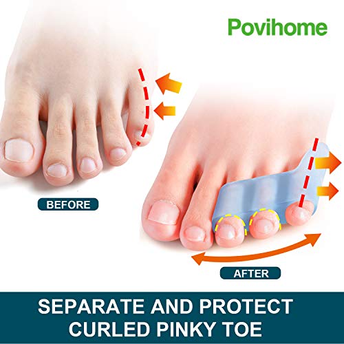 Povihome 10 Pack Pinky Toe Separator and Protectors, Toe Separator...