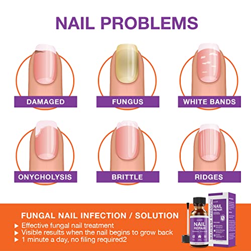 Pureskin Toenail Renewal - Maximum Strength Nail Repair Liquid, To...