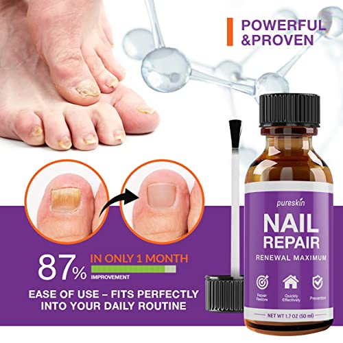 Pureskin Toenail Renewal - Maximum Strength Nail Repair Liquid, To...
