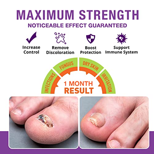 Pureskin Toenail Renewal - Maximum Strength Nail Repair Liquid, To...