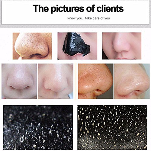 ROPALIA Activated Carbon Blackhead Remover Cream Deep Clean Purify...