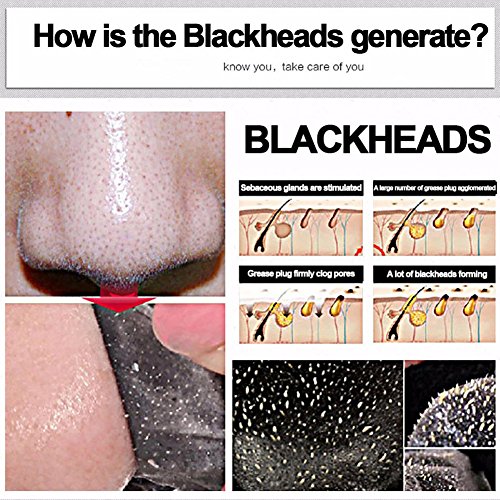 ROPALIA Activated Carbon Blackhead Remover Cream Deep Clean Purify...