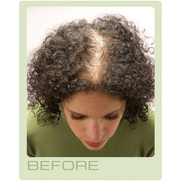 RX 4 Hair Loss Conditioner Natural & Organic Product Anti-Hair Los...