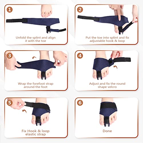 Scurnhau Toe Splint, Toe Straightener, Hammer Toe Corrector for Wo...
