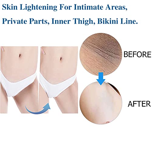 Skin Lightening Serum Whitening Serum For Intimate Areas, Private ...