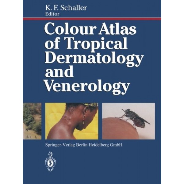 Colour Atlas of Tropical Dermatology and Venerology