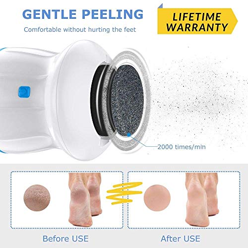 2020 LATEST Electronic Pedicure Foot File Callus Remover- Portab...