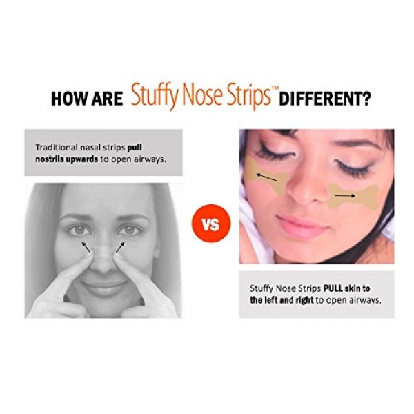 Nasal Strips - Stuffy Nose Strips - GO ON CHEEKS NOT OVER NOSES! I...